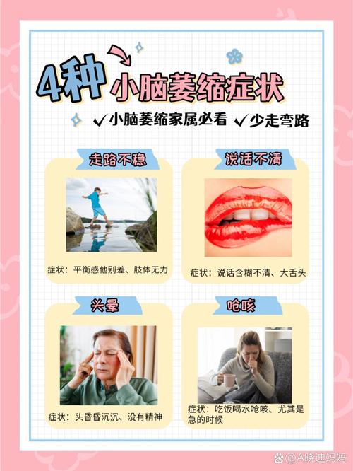 送小脑萎缩儿子高考,小脑萎缩能上学吗